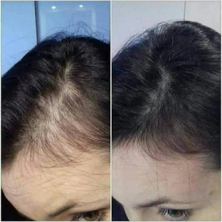 Power Hair Keratin – pousse rapide des cheveux