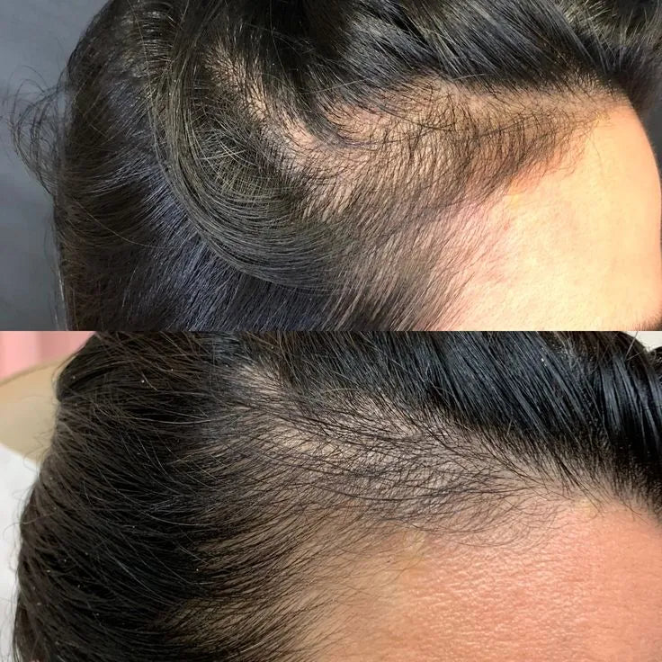 Power Hair Keratin – pousse rapide des cheveux