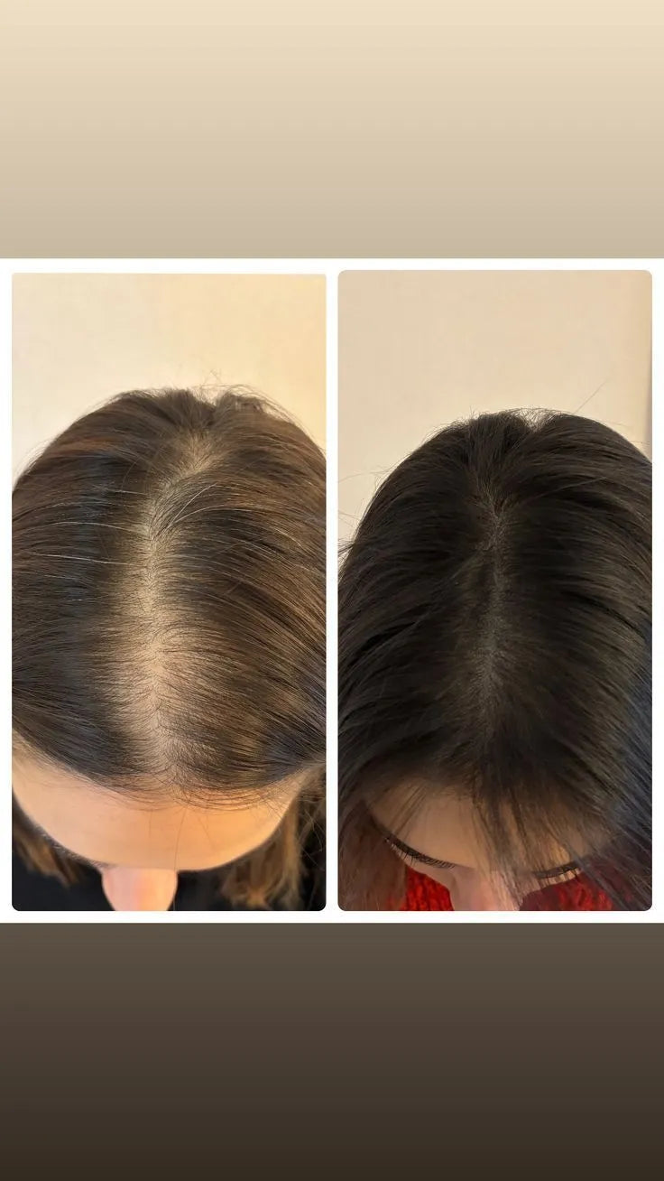 Power Hair Keratin – pousse rapide des cheveux