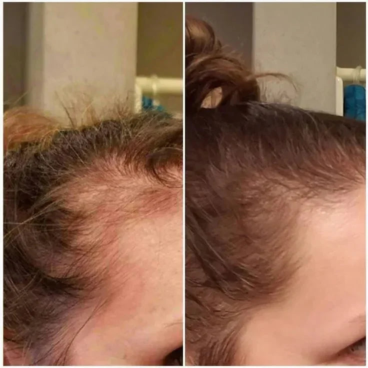 Avant-après pousse rapide des cheveux avec traitement à la kératine Power Hair Cynatine HNS